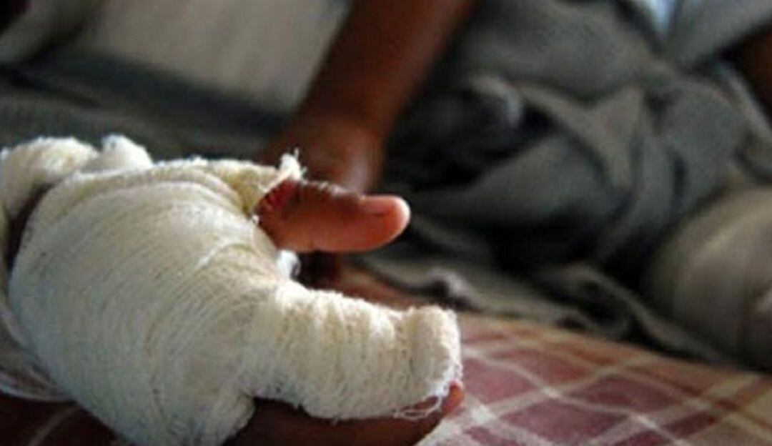 En el Huila 14 personas han resultado quemadas con pólvora durante el 2021.