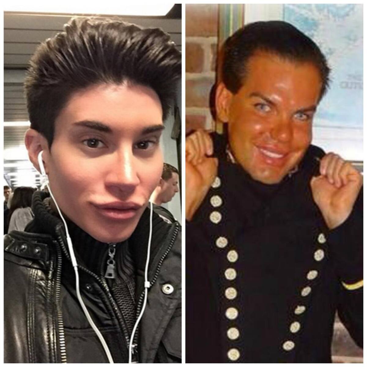 Los dos se han hecho varias cirugías plásticas para parecerse al novio de Barbie. Usted decide cuál está logrando su cometido.