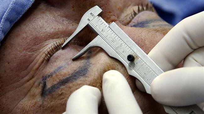 Cirugía plástica. Foto: Colprensa.