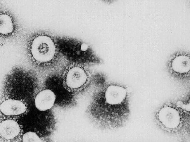 La estructura del coronavirus colapsaría al someterse al ultrasonido.