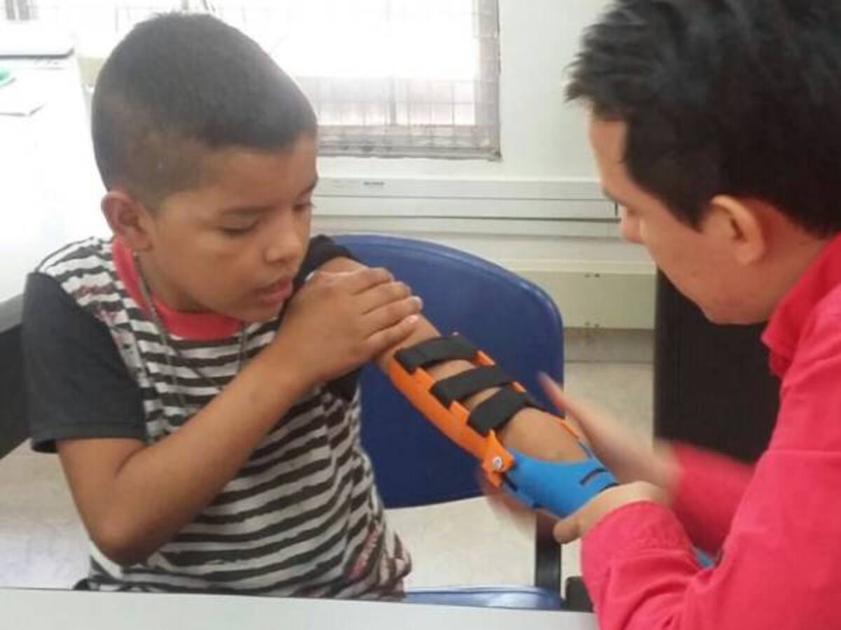 Se conoció en Neiva, la primera prótesis 3D creada con materiales de bajo costo