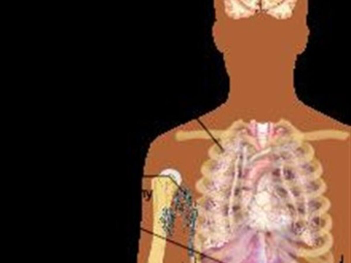 Niño con cáncer necesita medicamento del que depende su vida. Hablan Invima y EPS.