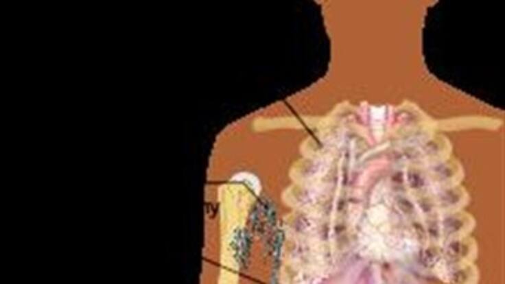 Niño con cáncer necesita medicamento del que depende su vida. Hablan Invima y EPS.