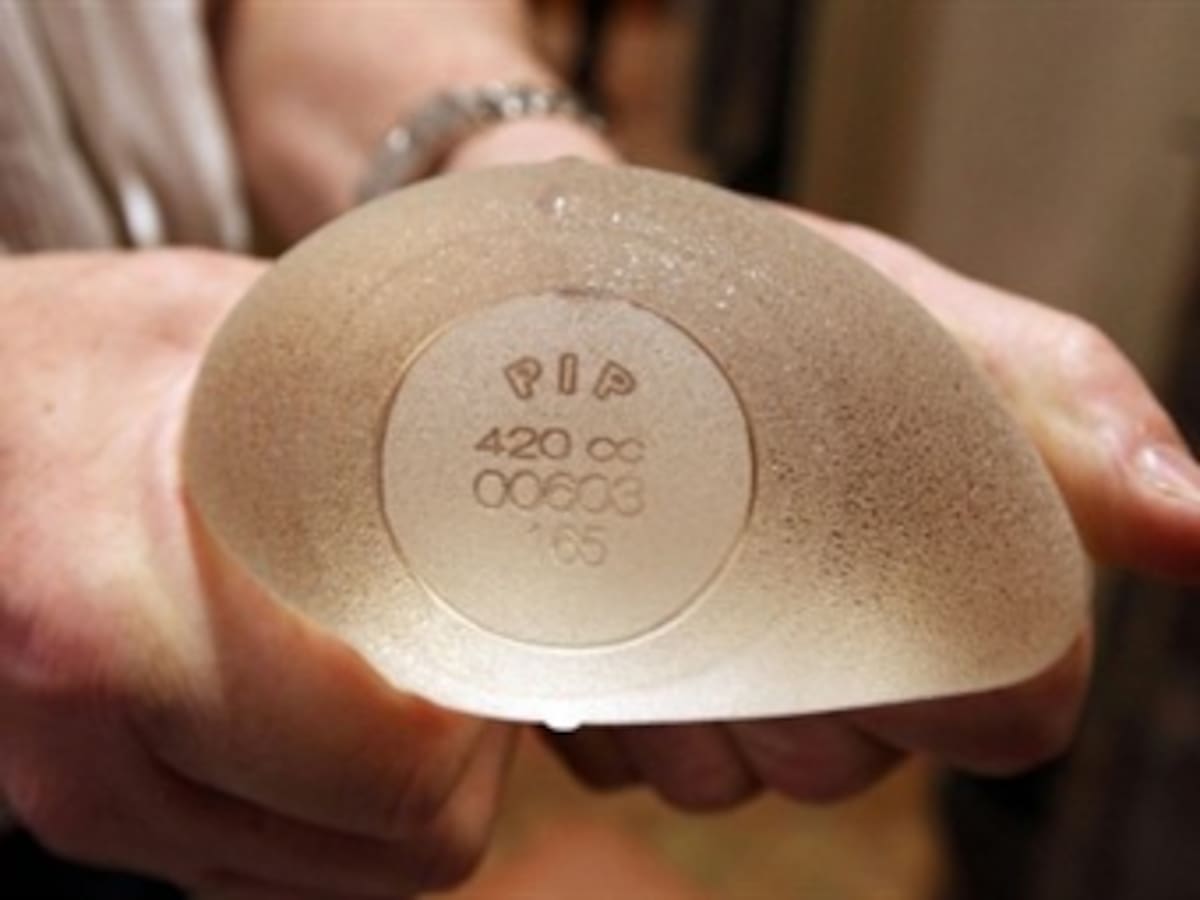 Sin costo 24 hospitales atenderán a las personas que tengan implantes PIP