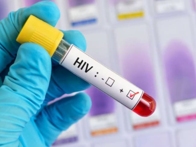Fundación Plataformas está practicado pruebas gratis de VIH en Manizales