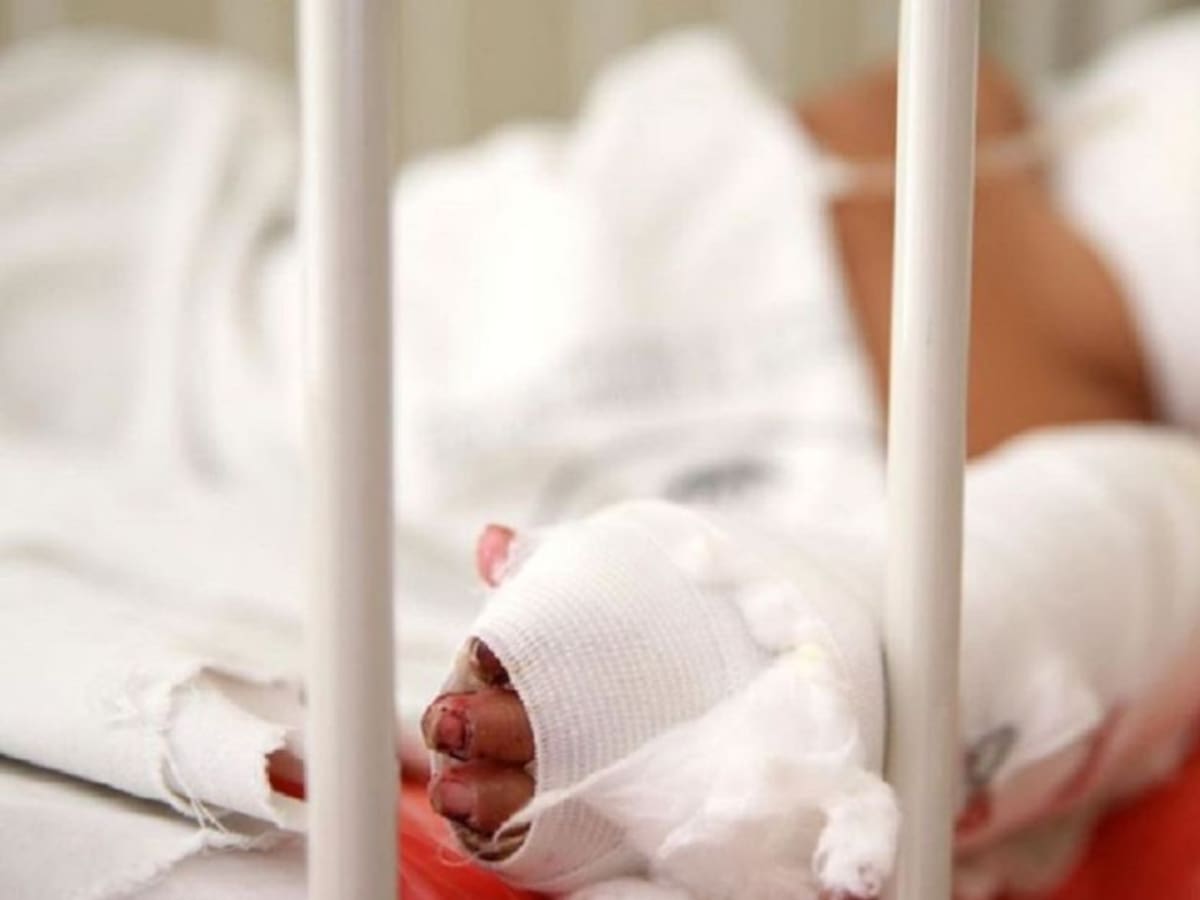 Bebé de 8 meses murió tras caerle líquido hirviente