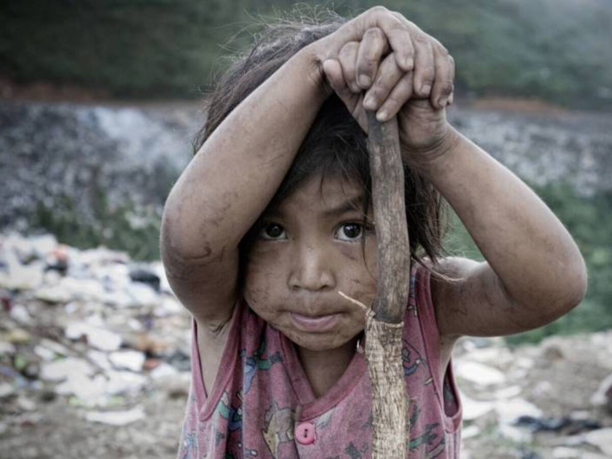 En Cali determinan muerte de niña de cinco meses por desnutrición crónica