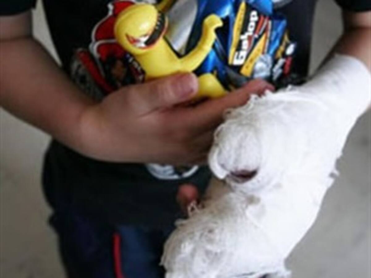 Ya son 12 las personas quemadas con pólvora en el Quindío
