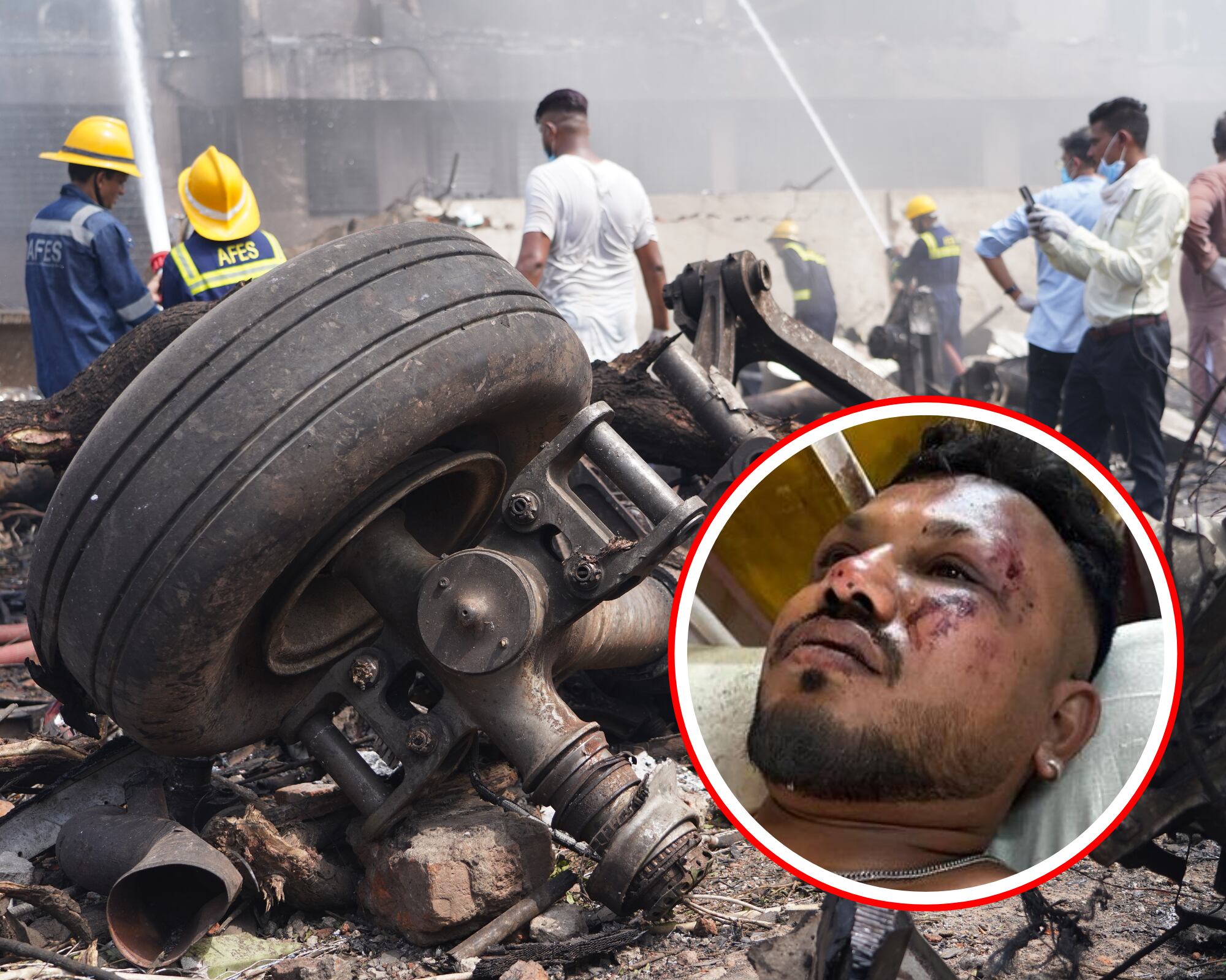 Vishwash Kumar Ramesh saltó del avión poco antes de que chocara y, según los primeros rescatistas, estaba cojeando después del accidente.
(Foto: Cortesía / Getty )