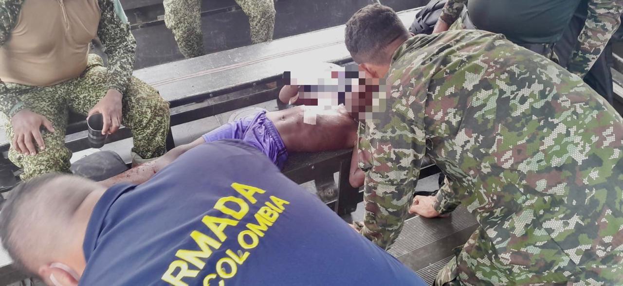 Niño de nueve años fue víctima de mina antipersonal instalada por el ELN en Chocó.