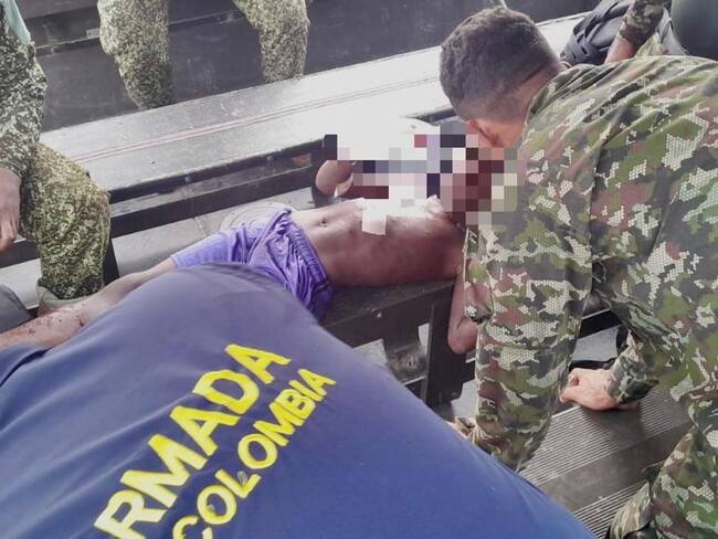 Niño de nueve años fue víctima de mina antipersonal instalada por el ELN en Chocó.