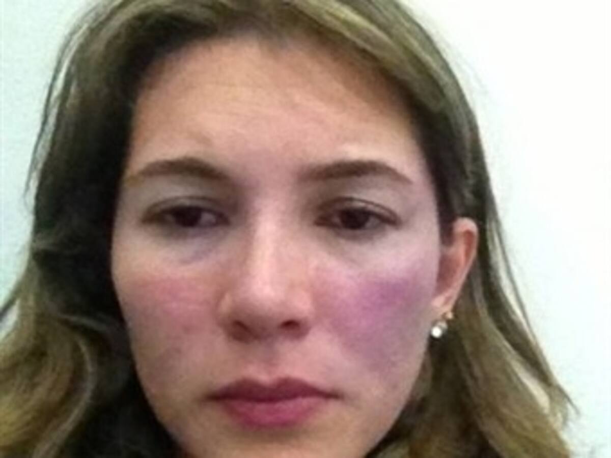 Denuncian que congresista le propinó una paliza a su esposa
