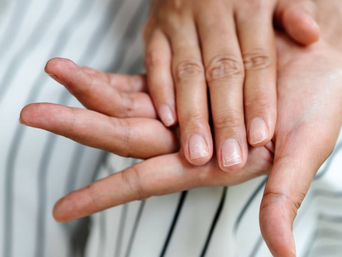 ¿Color en sus uñas? Podría tener estas graves enfermedades