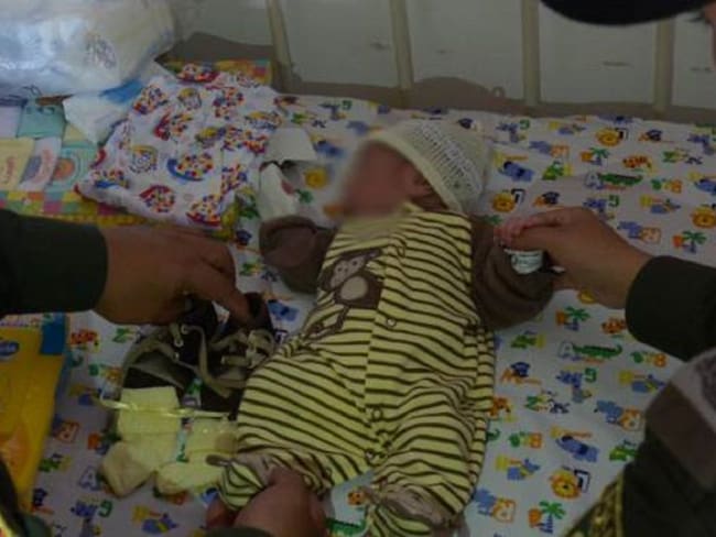 Falleció niña de dos meses por desnutrición aguda