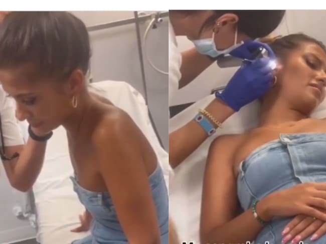 Extraen un bicho de su oído - Instagram