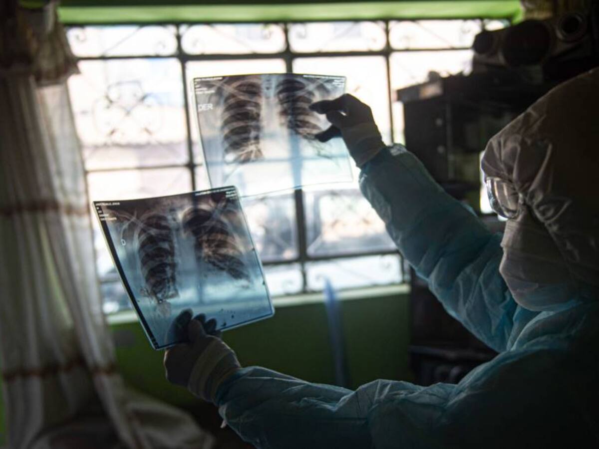 Perú lanza alerta epidemiológica por brote de influenza A