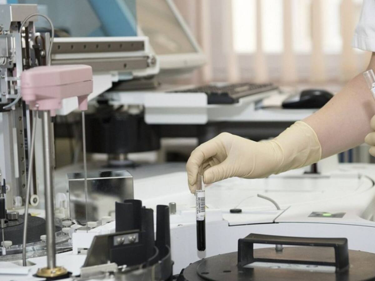 Según estudios la Lactoferrina puede prevenir el Coronavirus