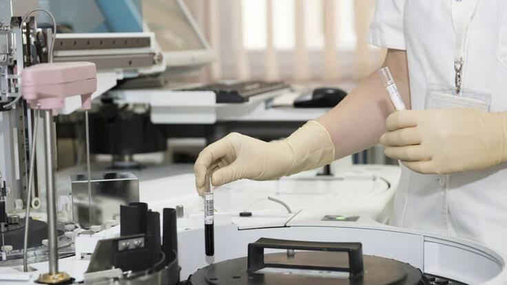 Según estudios la Lactoferrina puede prevenir el Coronavirus
