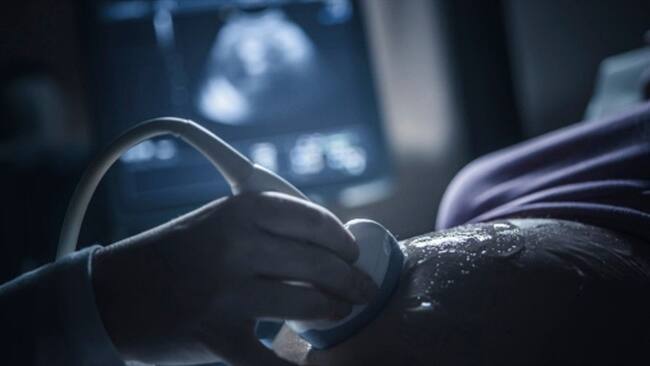 Simulaba vientre a través de elementos: Policía sobre falso rapto de neonato. Foto: Getty Images