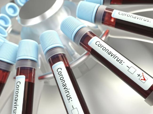 INS capacitó a otros siete laboratorios para prueba de coronavirus