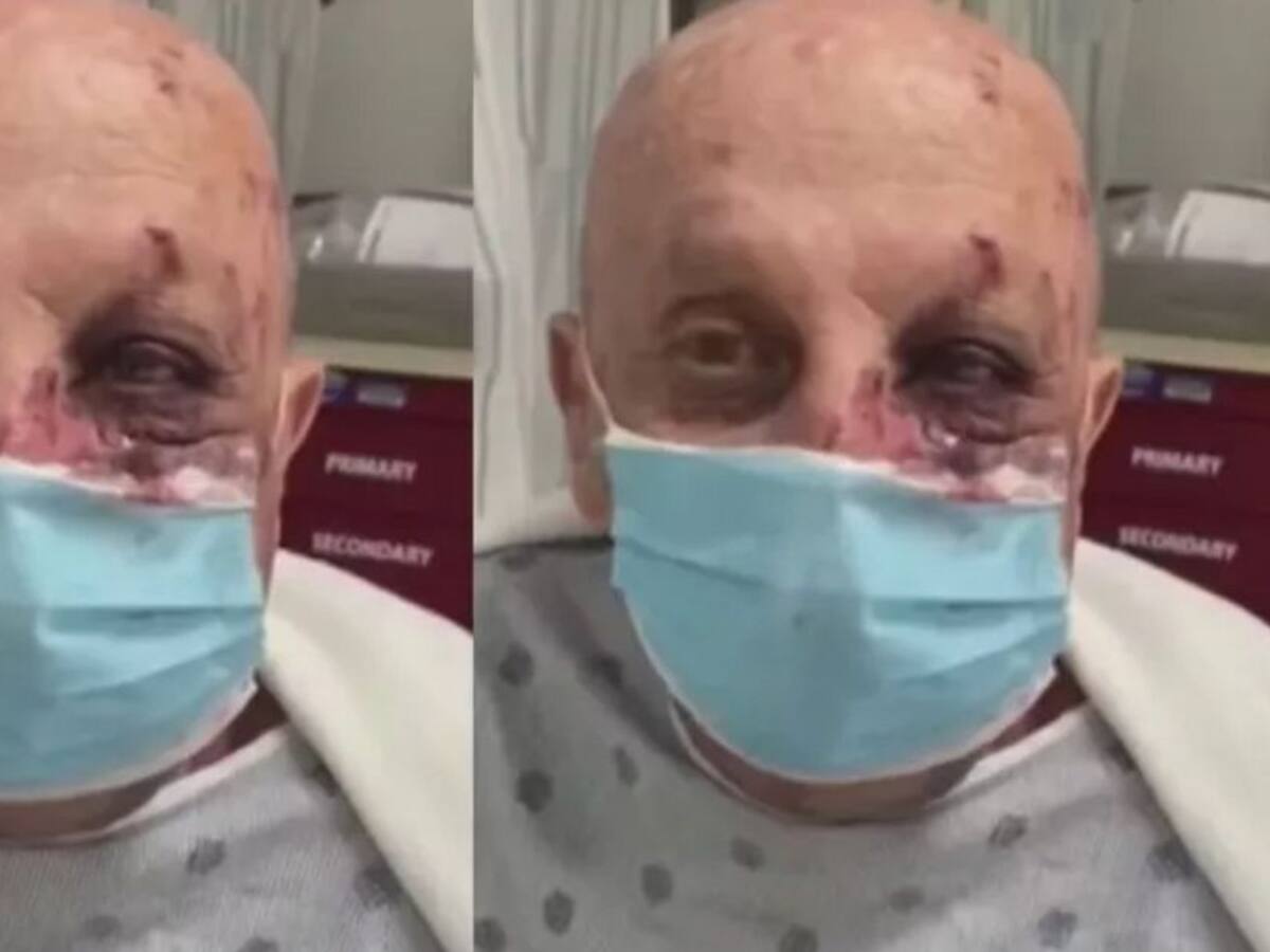 (VIDEO) Así fue agredido anciano por afroamericano en metro de Miami