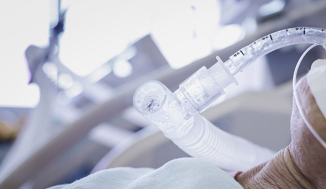 En las últimas semanas se ha evidenciado una tendencia de reducción tanto en los casos positivos como en mortalidad por el virus SarsCov2.