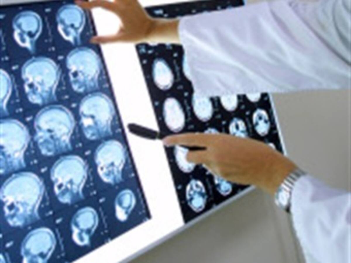 Neurólogo asegura que el Parkinson no es un obstáculo para gobernar
