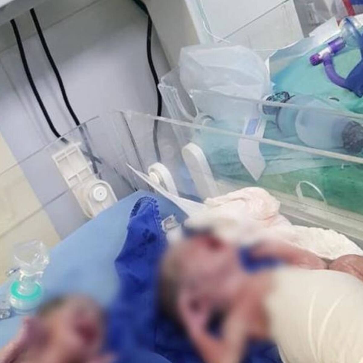 ¡Milagro en la cuarentena! Nacen trillizos en Santa Marta