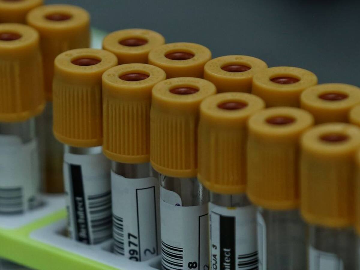 Bogotá desde ya está adaptando sus sedes para la llegada de la vacuna