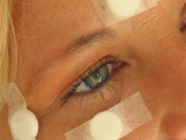 Stiper-puntura: una técnica para aliviar el dolor