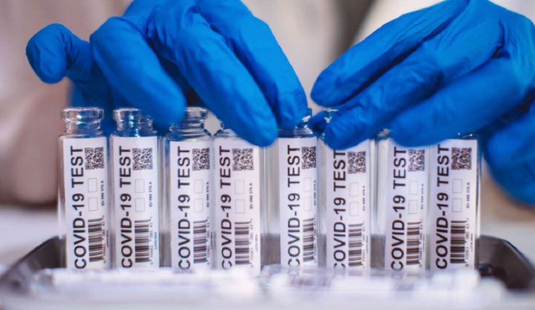 Prueba contra el Covid-19
