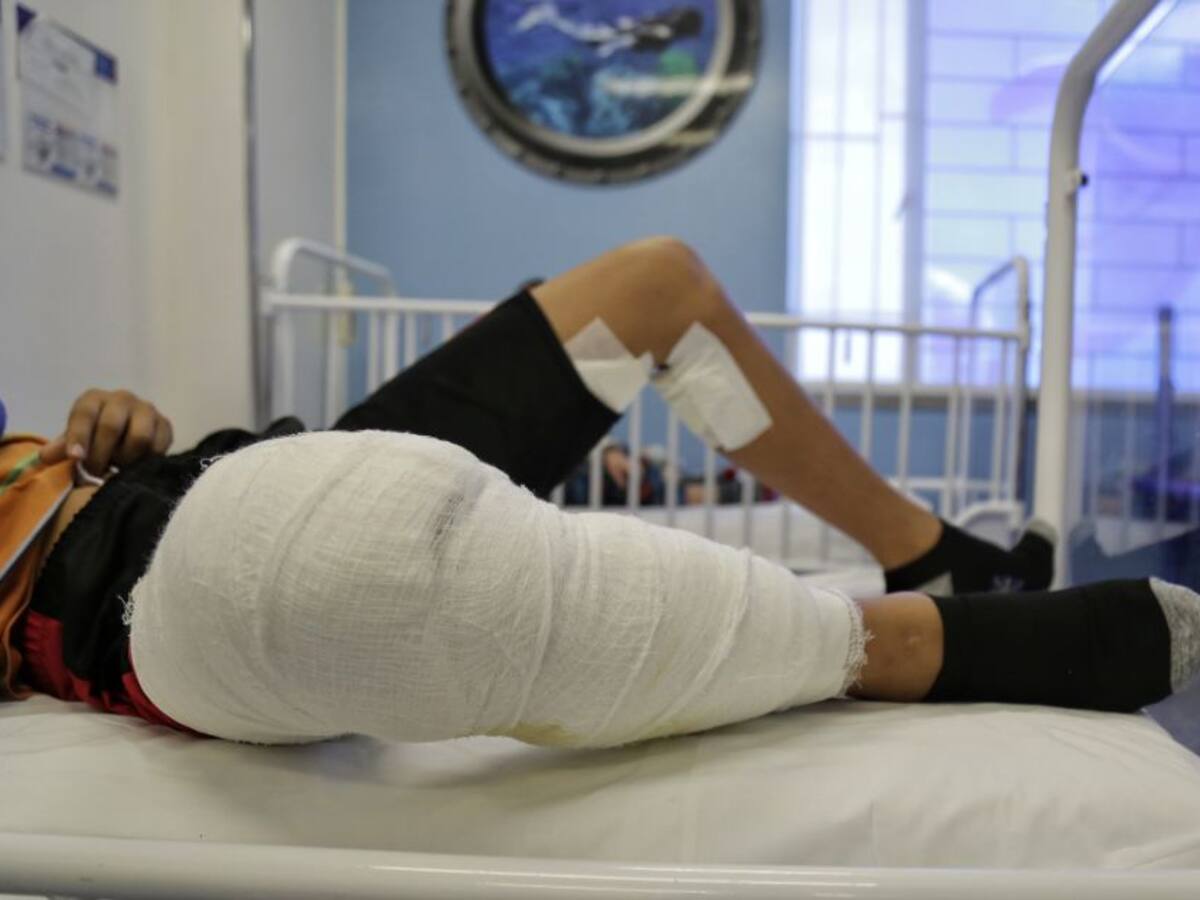 Más quemados por pólvora en Colombia este año que en el 2017