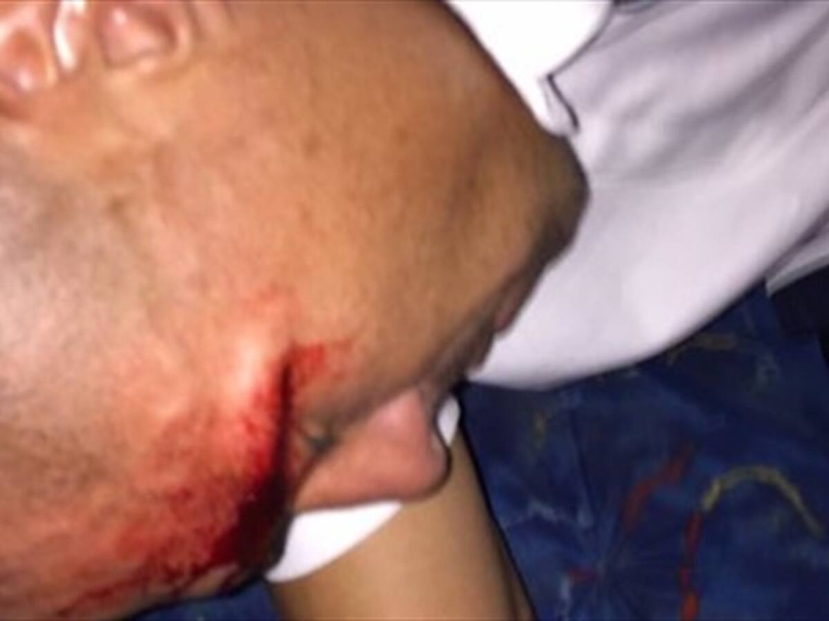 Vladimir Marín recibió dos puntos, tras ataque al bus del Medellín