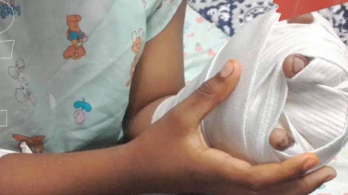 Antioquia completó 32 casos de personas lesionadas con pólvora