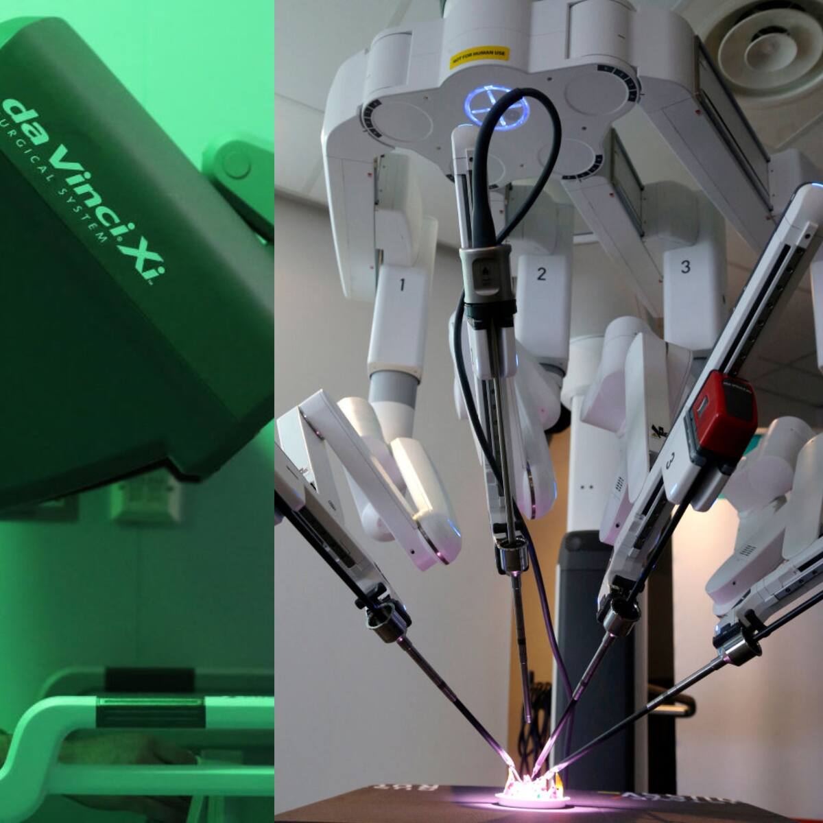 Último equipo que llegó a Bogotá y el de más alta tecnología: Clínica del Country sobre Da Vinci Xi