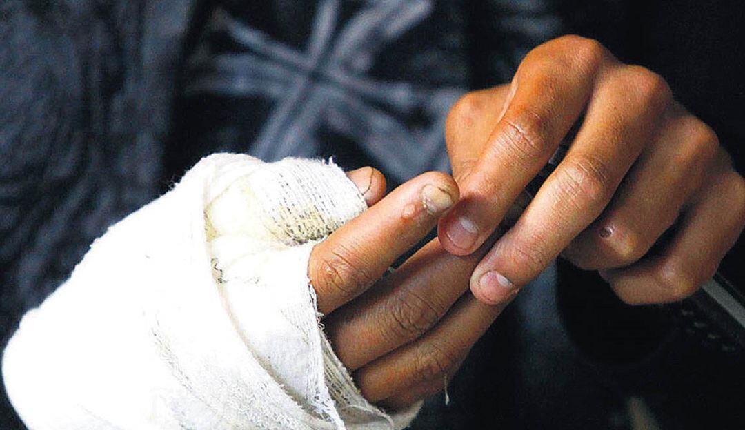 Un llamado urgente hace las autoridades para frenar las consecuencias del uso de estos artefactos.