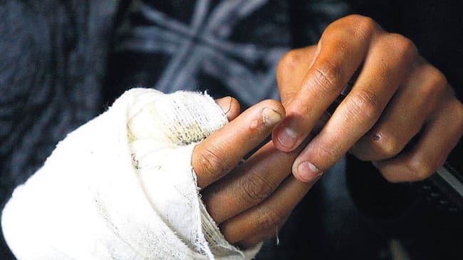 Un llamado urgente hace las autoridades para frenar las consecuencias del uso de estos artefactos.