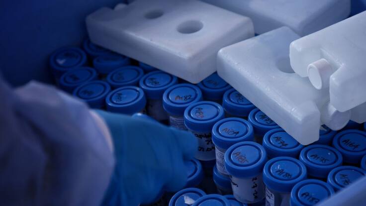 “Las pruebas de anticuerpos solo se deben utilizar para la investigación”