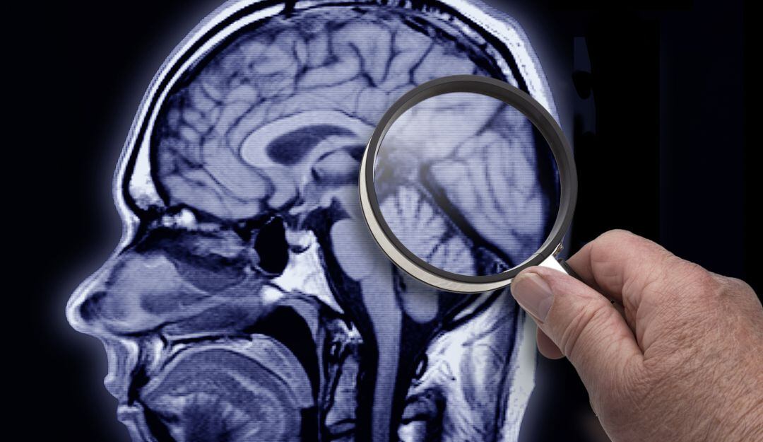 Imagen de referencia