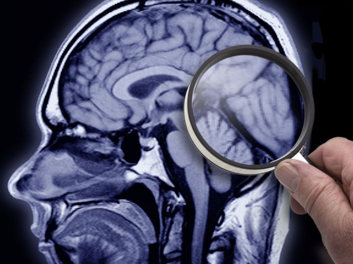 Estos son los alimentos más peligrosos para el cerebro