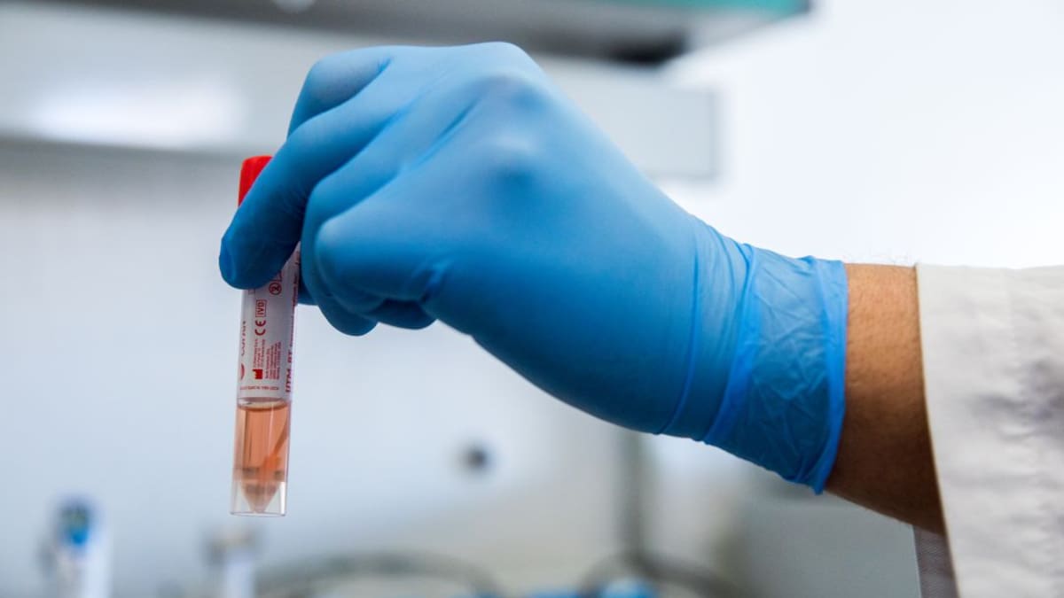 En Antioquia hay 892 casos de Coronavirus activos, en Urabá 220