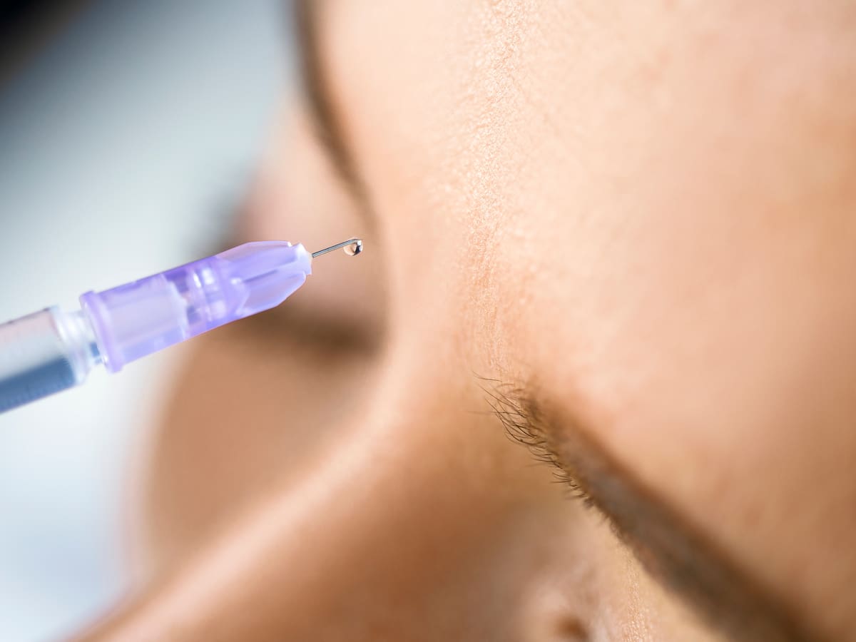 Rejuvenecimiento facial 3D: ¿En qué consiste? ¿Es bueno?