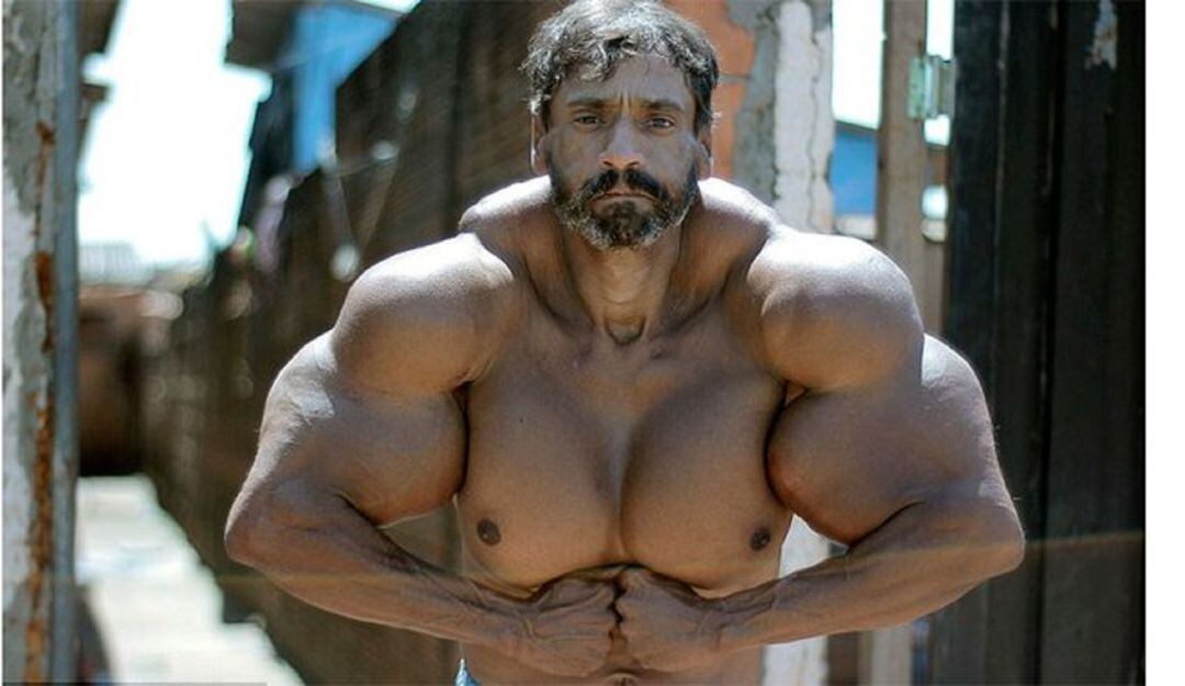 Murió el "Hulk brasileño" por aumentar sus músculos con aceite