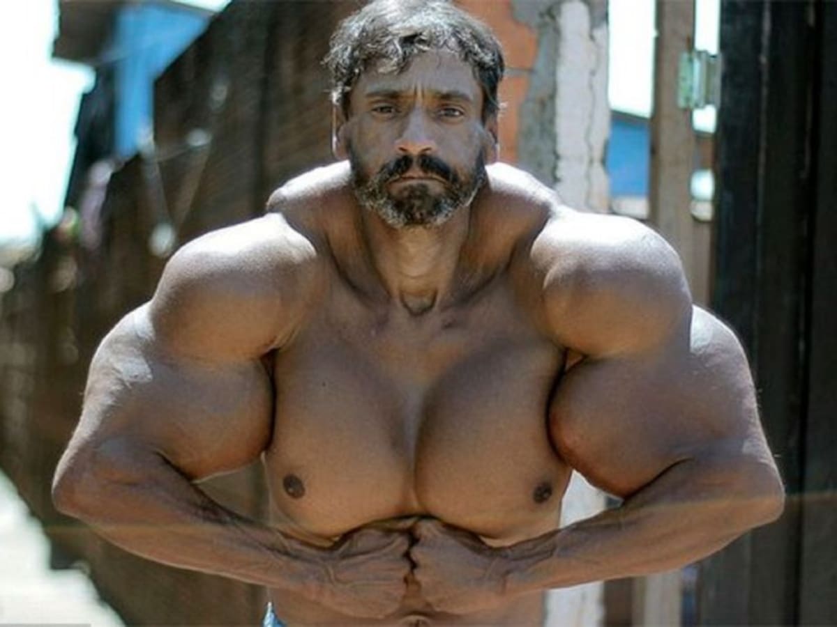 Murió el "Hulk brasileño" por aumentar sus músculos con aceite