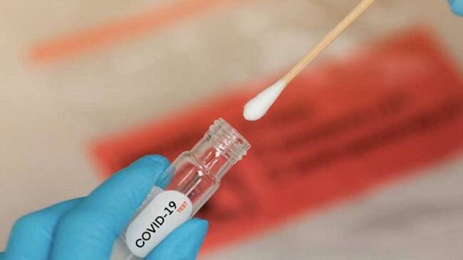 Víctimas mortales del virus siguen siendo los adultos mayores, los efectos graves y los fallecimientos pueden ser evitables con las vacunas.