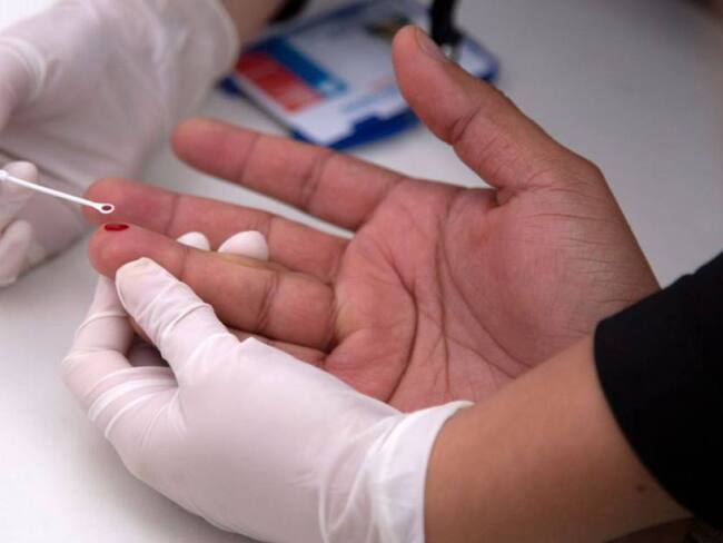 Más de 600 casos de VIH en Barranquilla en el 2020