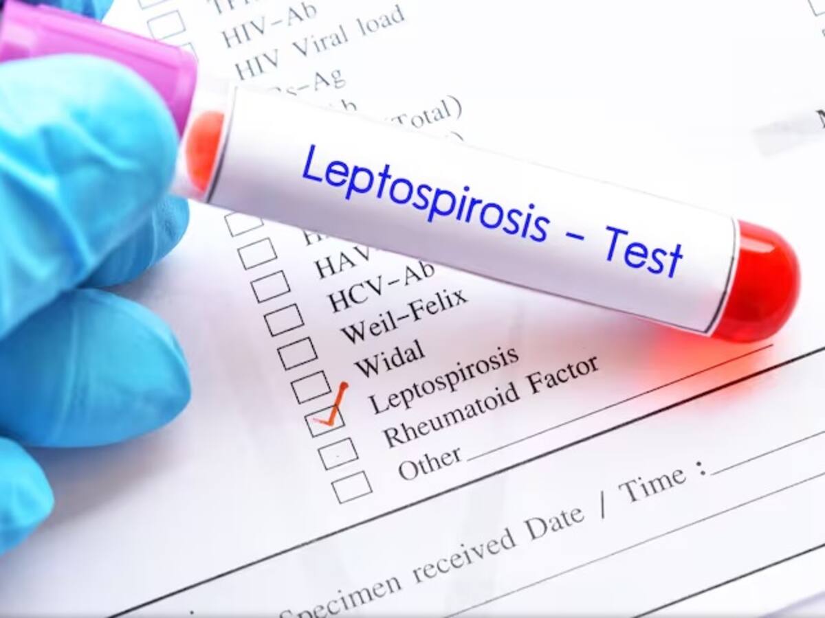 En Dosquebradas investigan más de 30 posibles casos de leptospirosis