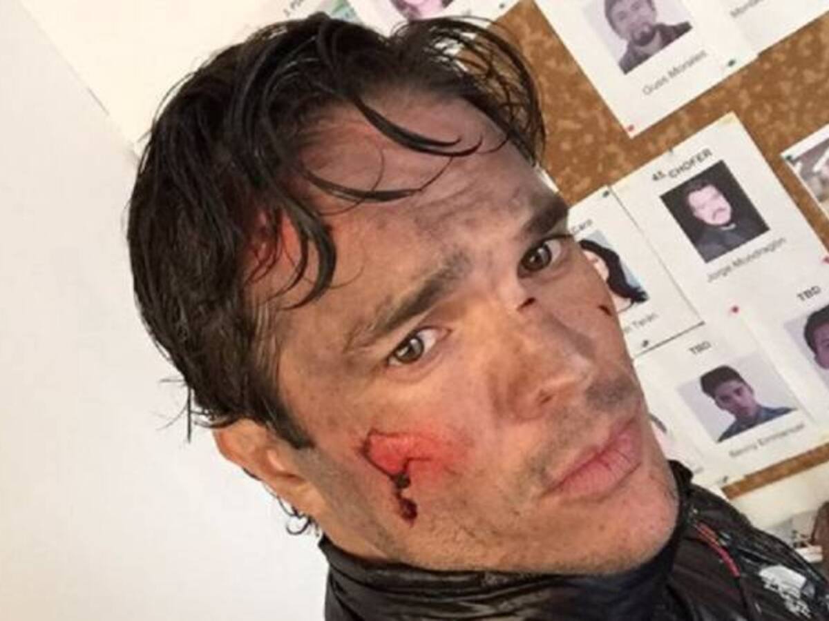 Por uso de maquillaje Kuno Becker perdió parte de su visión