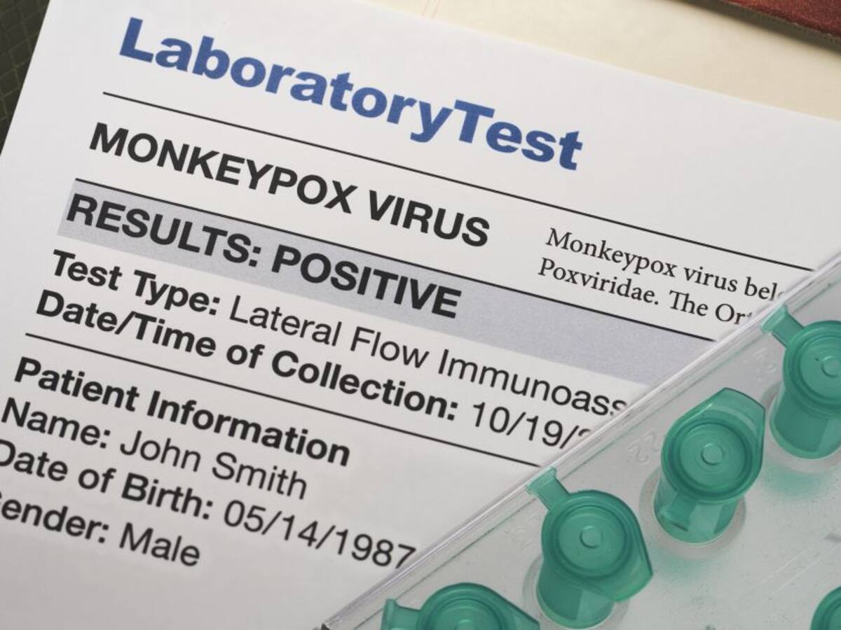 OMS reconoce el desconocimiento que hay de la viruela del mono