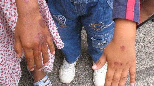 Imagen de referencia. Foto: Colprensa